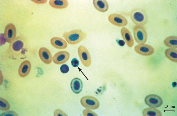 slika1(IHN nekrobioticka tela)