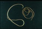 1280px-Paragordius_tricuspidatus